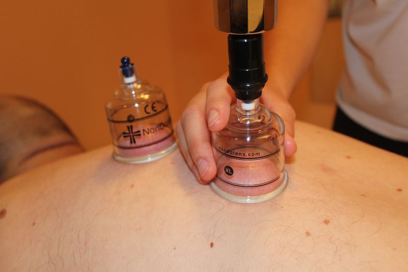 Köpöly kezelés alkalmazása